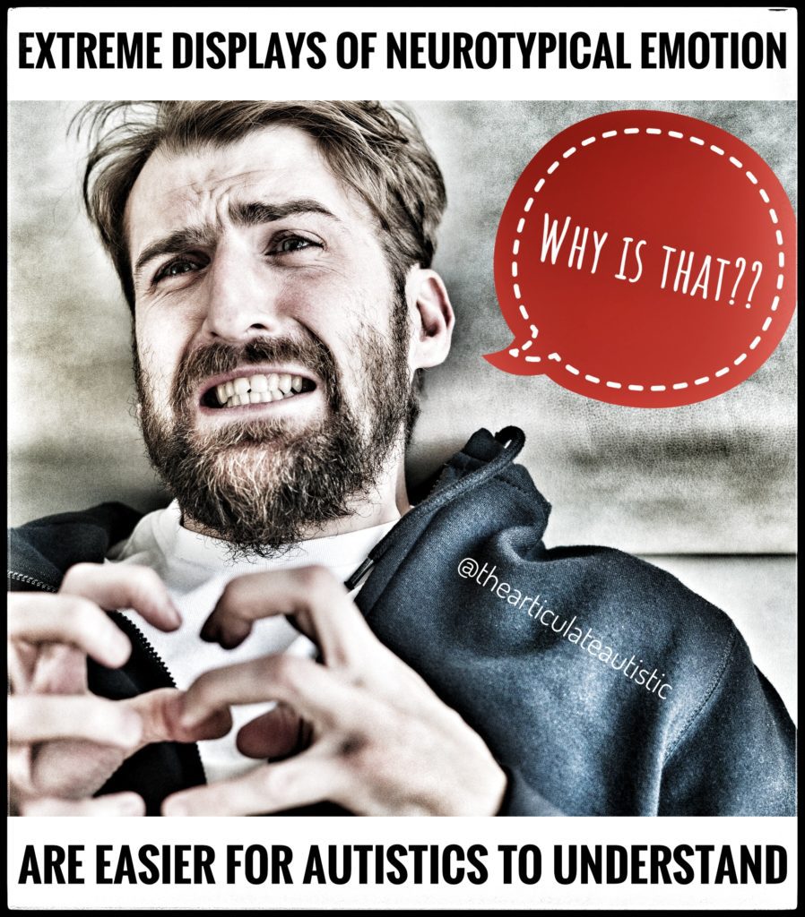 A man with clenched fingers and teeth looking very upset. Text reads, "Extreme Displays of Neurotypical Emotion Are Easier for Autistics to Understand - Why Is That??"